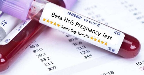 Rối loạn hormone HCG